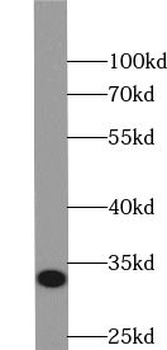 TST Rabbit Polyclonal Antibody