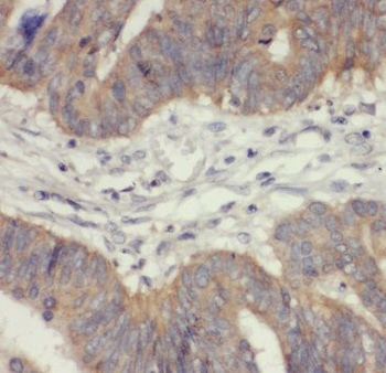 TST Rabbit Polyclonal Antibody
