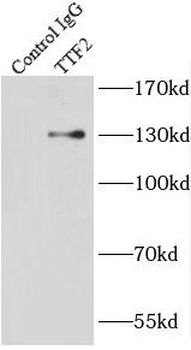 TTF2 Rabbit Polyclonal Antibody