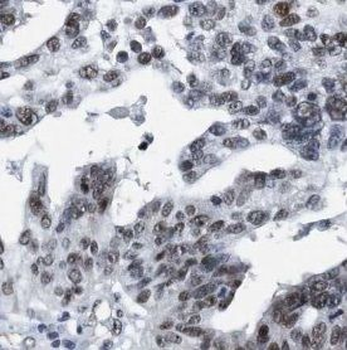 TTF2 Rabbit Polyclonal Antibody