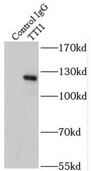 TTI1 Rabbit Polyclonal Antibody