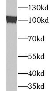 TUBGCP3 Rabbit Polyclonal Antibody