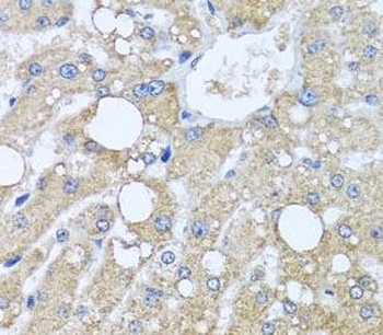 TUBGCP3 Rabbit Polyclonal Antibody