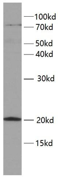 TWIST2 Rabbit Polyclonal Antibody