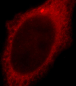TXNDC17 Rabbit Polyclonal Antibody