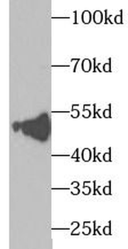 TXNDC5 Rabbit Polyclonal Antibody