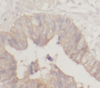 TXNDC5 Rabbit Polyclonal Antibody