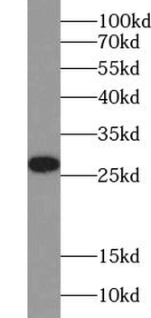 TXNDC9 Rabbit Polyclonal Antibody