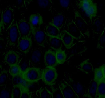 TXNIP Rabbit Polyclonal Antibody