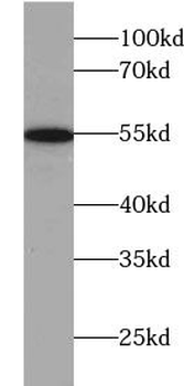 TXNRD1 Rabbit Polyclonal Antibody
