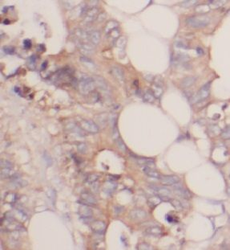 UBA5 Rabbit Polyclonal Antibody