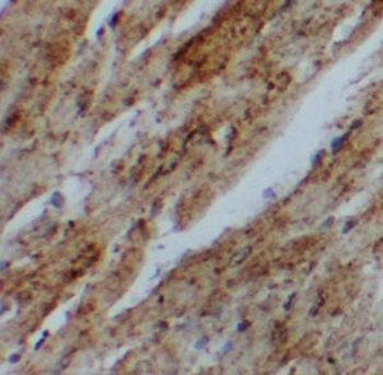 UBAC1 Rabbit Polyclonal Antibody