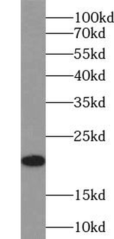 UBE2M Rabbit Polyclonal Antibody