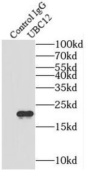 UBE2M Rabbit Polyclonal Antibody