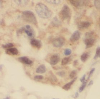 UBE2N Rabbit Polyclonal Antibody