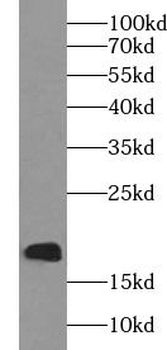 UBD Rabbit Polyclonal Antibody