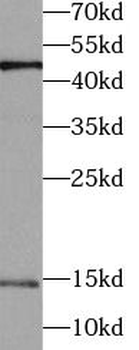 UBE2A Rabbit Polyclonal Antibody