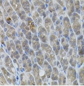 UBE2A Rabbit Polyclonal Antibody