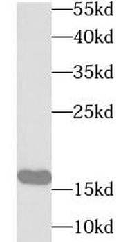 UBE2B Rabbit Polyclonal Antibody