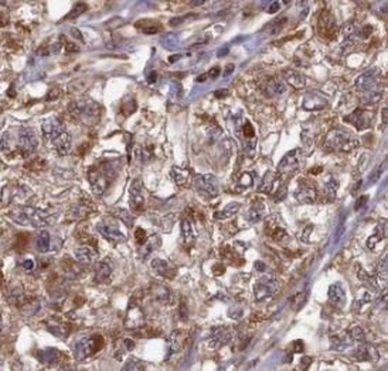 UBE2B Rabbit Polyclonal Antibody