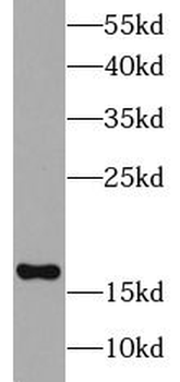UBE2C Rabbit Polyclonal Antibody