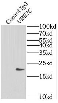 UBE2C Rabbit Polyclonal Antibody