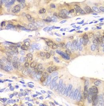 UBE2C Rabbit Polyclonal Antibody