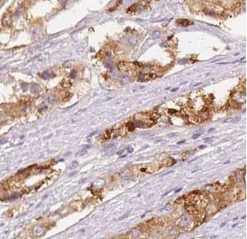 UBE2D3 Rabbit Polyclonal Antibody