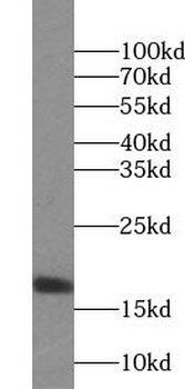 UBE2D4 Rabbit Polyclonal Antibody