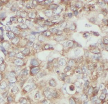 UBE2D4 Rabbit Polyclonal Antibody