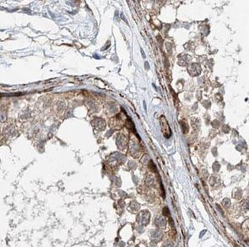 UBE2F Rabbit Polyclonal Antibody