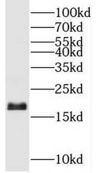 UBE2G2 Rabbit Polyclonal Antibody