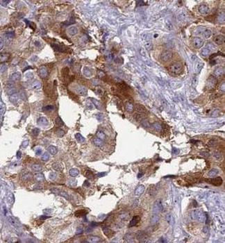 UBE2G2 Rabbit Polyclonal Antibody