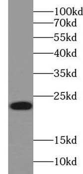 UBE2H Rabbit Polyclonal Antibody
