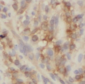 UBE2H Rabbit Polyclonal Antibody