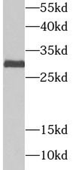 UBE2J2 Rabbit Polyclonal Antibody