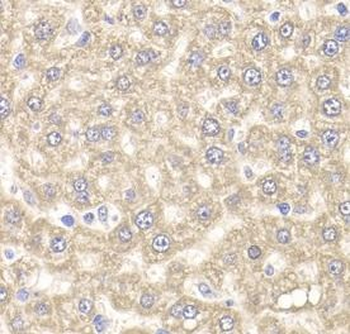 UBE2J2 Rabbit Polyclonal Antibody