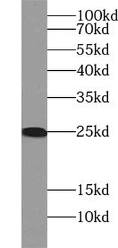 UBE2K Rabbit Polyclonal Antibody
