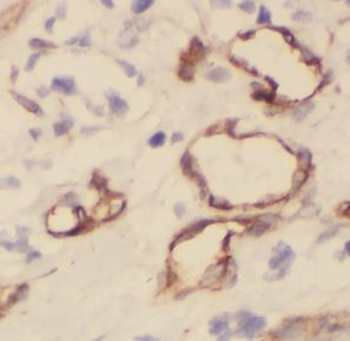 UBE2K Rabbit Polyclonal Antibody