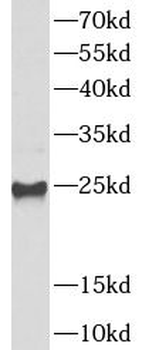 UBE2S Rabbit Polyclonal Antibody