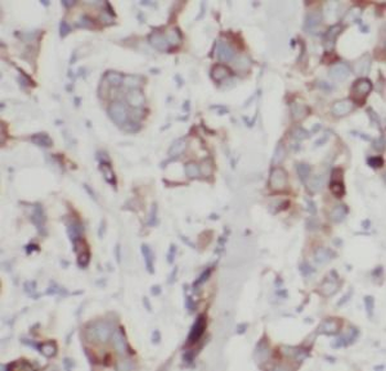 UBE2S Rabbit Polyclonal Antibody