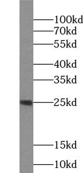 UBE2T Rabbit Polyclonal Antibody