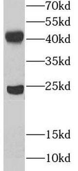 UBE2Z Rabbit Polyclonal Antibody