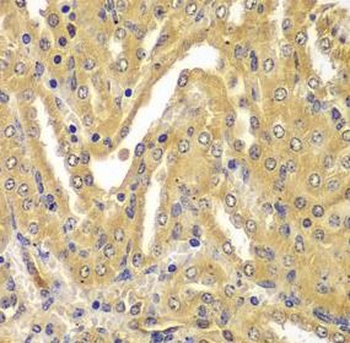 UBE2Z Rabbit Polyclonal Antibody