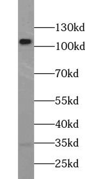UBE3A Rabbit Polyclonal Antibody