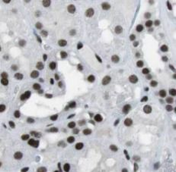 UBE3A Rabbit Polyclonal Antibody