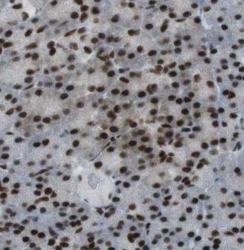 UBR2 Rabbit Polyclonal Antibody