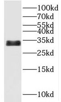 UCMA Rabbit Polyclonal Antibody