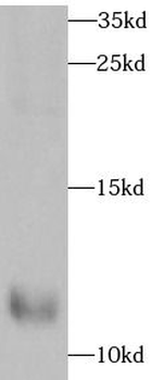 UCN2 Rabbit Polyclonal Antibody