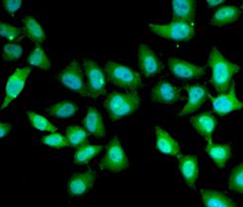 UCN2 Rabbit Polyclonal Antibody